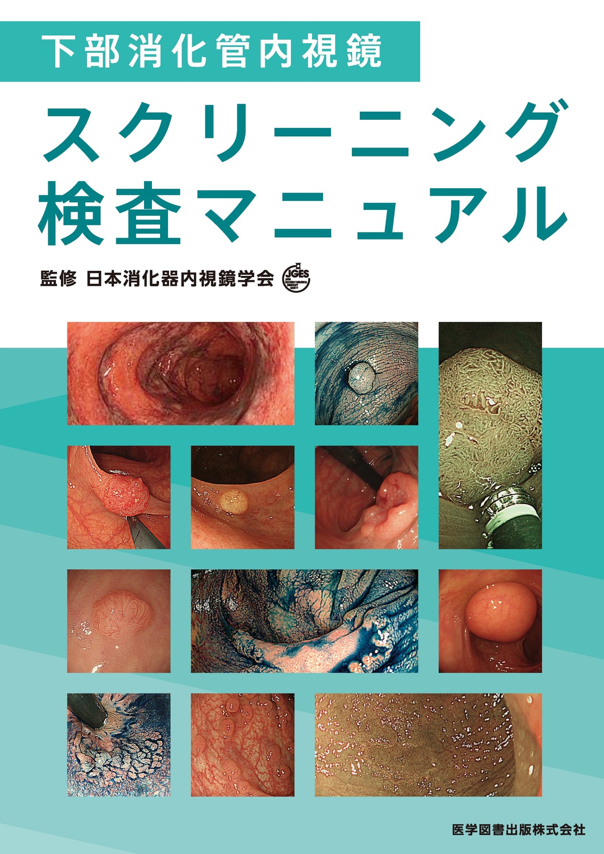 下部消化管内視鏡スクリーニング検査マニュアル